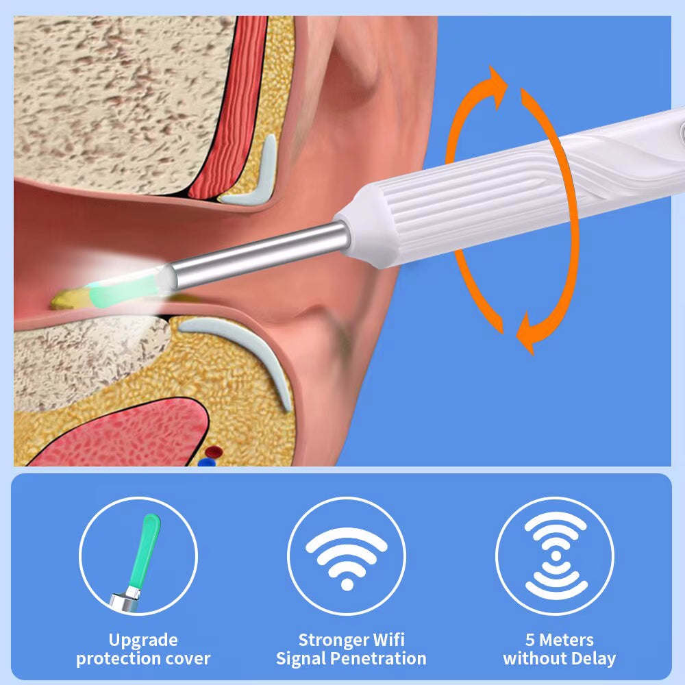 Wireless Ear Cleaner with Camera HD Earwax Remover 6 LED Lights Waterproof Otoscope Ear Wax Removal Kit for Iphone Android